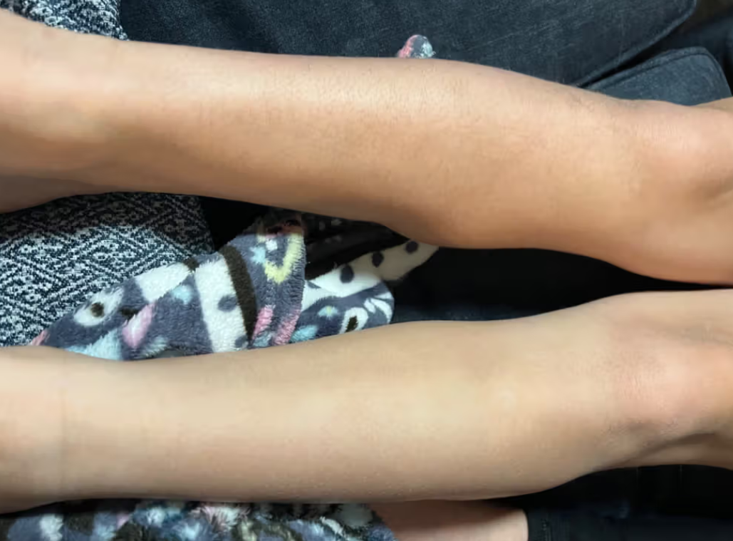 Selia Hair Eraser – Кристалена пила за гладка кожа