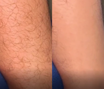 Selia Hair Eraser – Кристалена пила за гладка кожа