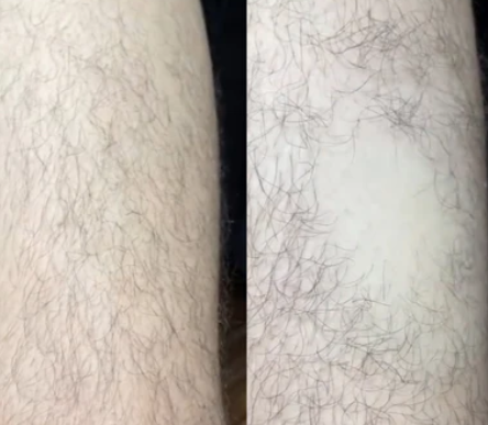 Selia Hair Eraser – Кристалена пила за гладка кожа