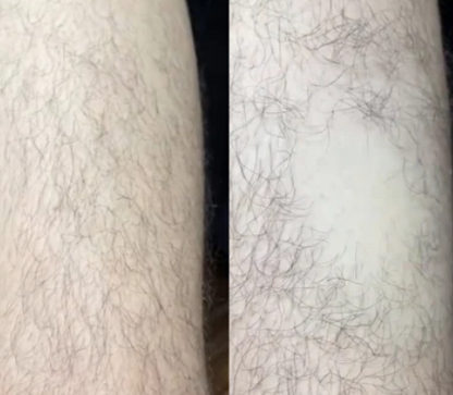 Selia Hair Eraser – Кристалена пила за гладка кожа